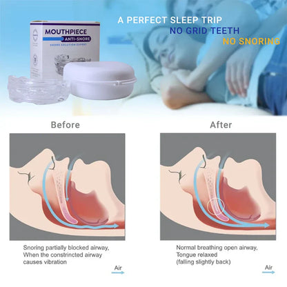 Premium Anti-Snoring Mouthpiece - Superior Sleep Support