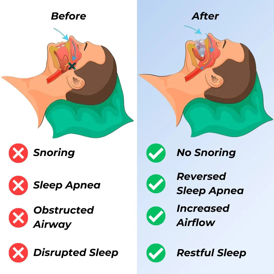 Premium Anti-Snoring Mouthpiece - Superior Sleep Support
